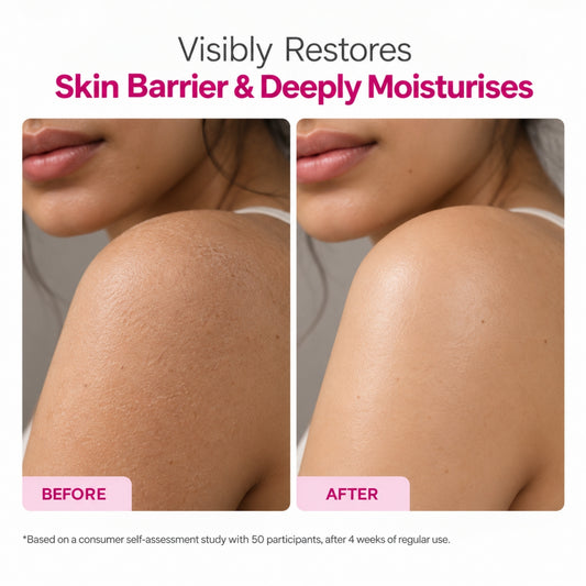 Ceramide + Peptide Body Lotion with 4.2% Actives, Niacinamide + Cocoa & Shea Butter – 300ml