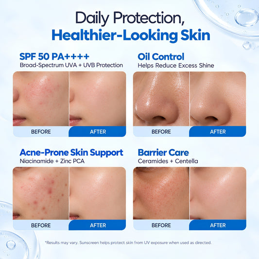 Oil + Acne Control Sunscreen SPF 50 PA++++ with Niacinamide & Zinc PCA – 50g