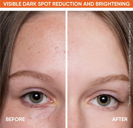 Why is Vitamin C so popular?