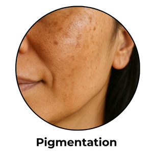 pigmentation