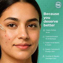 Acne Face Serum with 5% Niacinamide & 1% salicylic acid 30ml