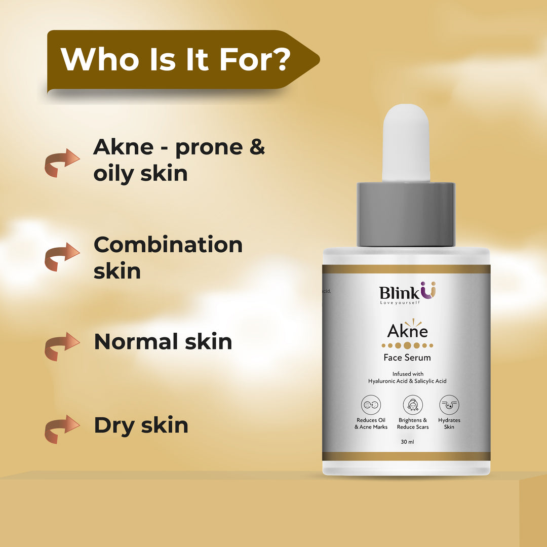 Akne face serum 30ml
