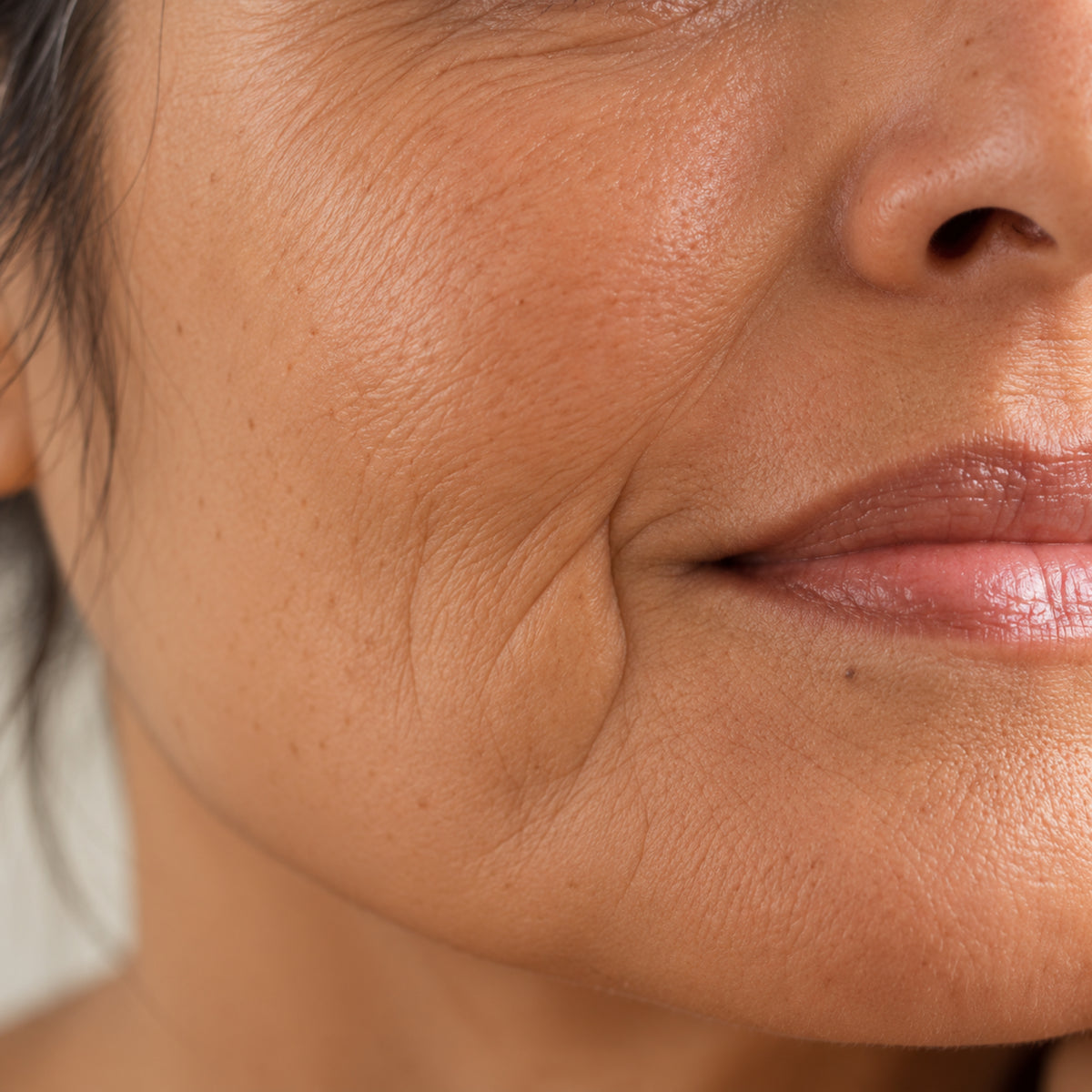 Anti-Aging