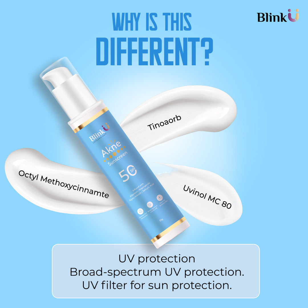 Acne Sunscreen 50g