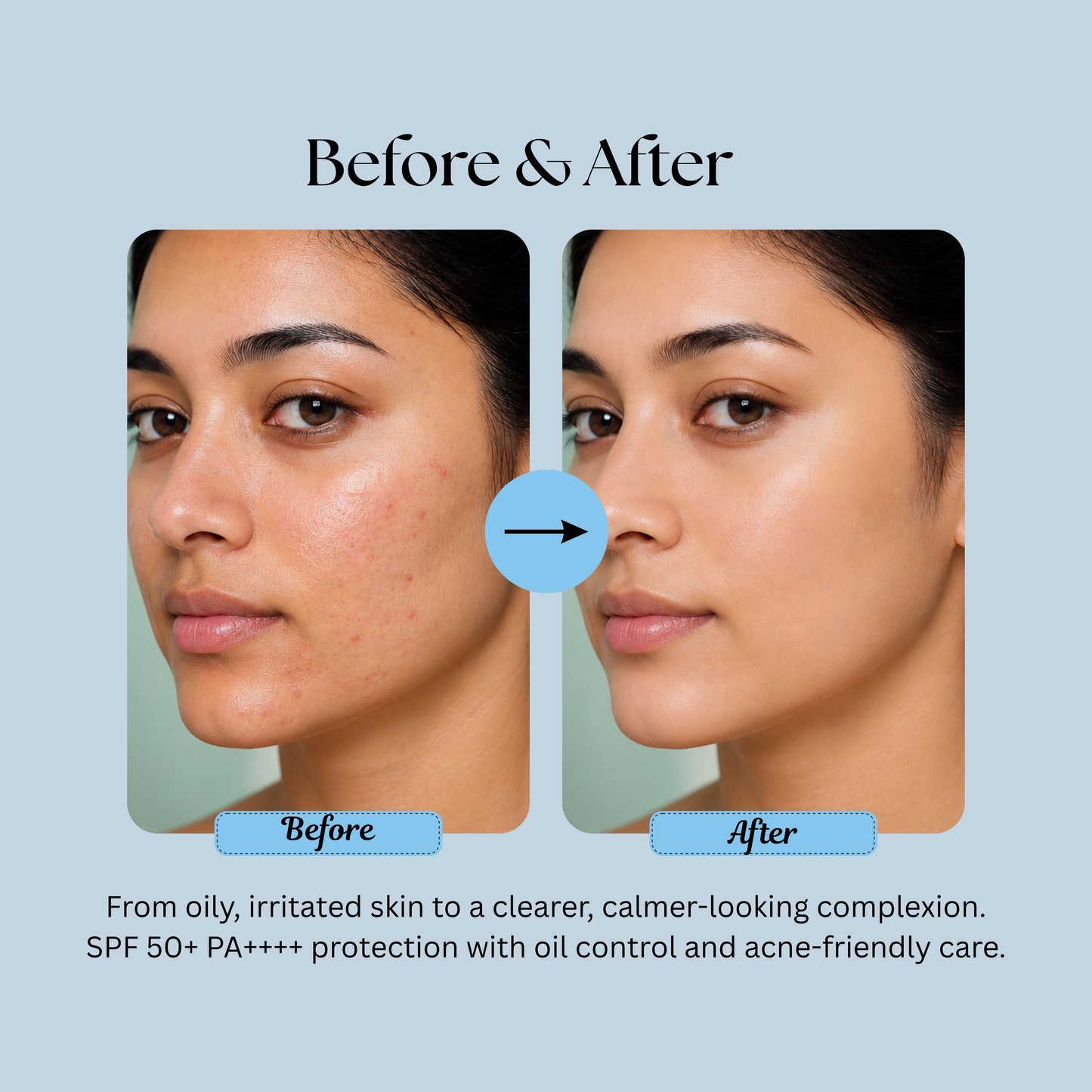 Oil + Acne Control Sunscreen SPF 50 PA++++