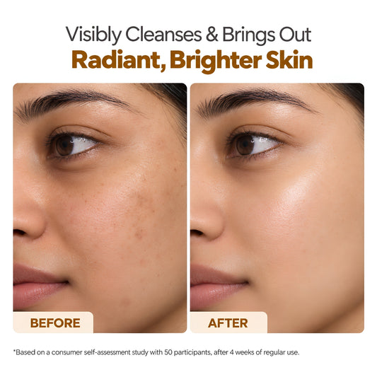 GlutaRadiance Face Wash with Glutathione & Kaolin Clay for Pigmentation – 100ml