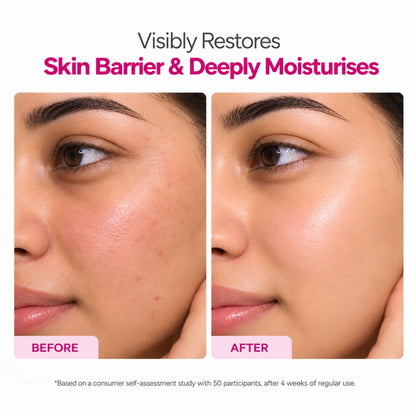 Ceramide + Peptide Face Cream with 3.1% Actives, Vitamin E + Caraplex 6T10 & Betaine – 100g