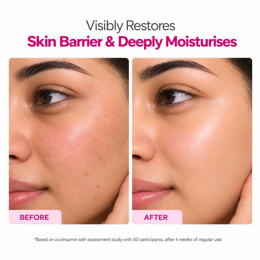 Ceramide + Peptide Face Cream with 3.1% Actives, Vitamin E + Caraplex 6T10 & Betaine – 100g