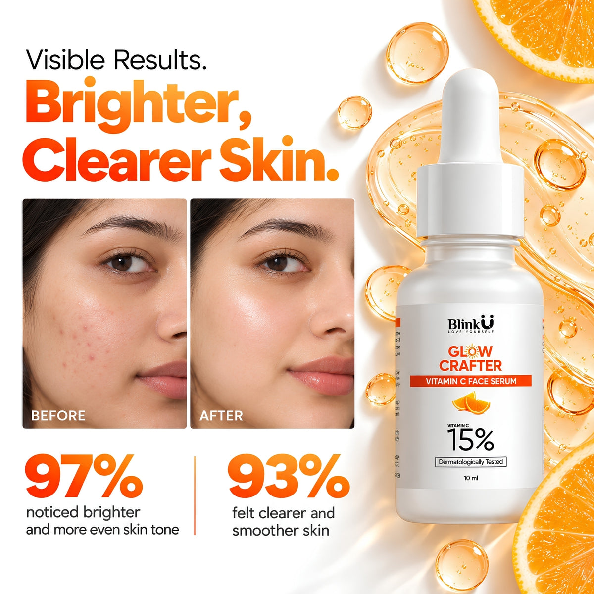 15% Vitamin C Face Serum with Ethyl Ascorbic Acid & Ferulic Acid – 10ml