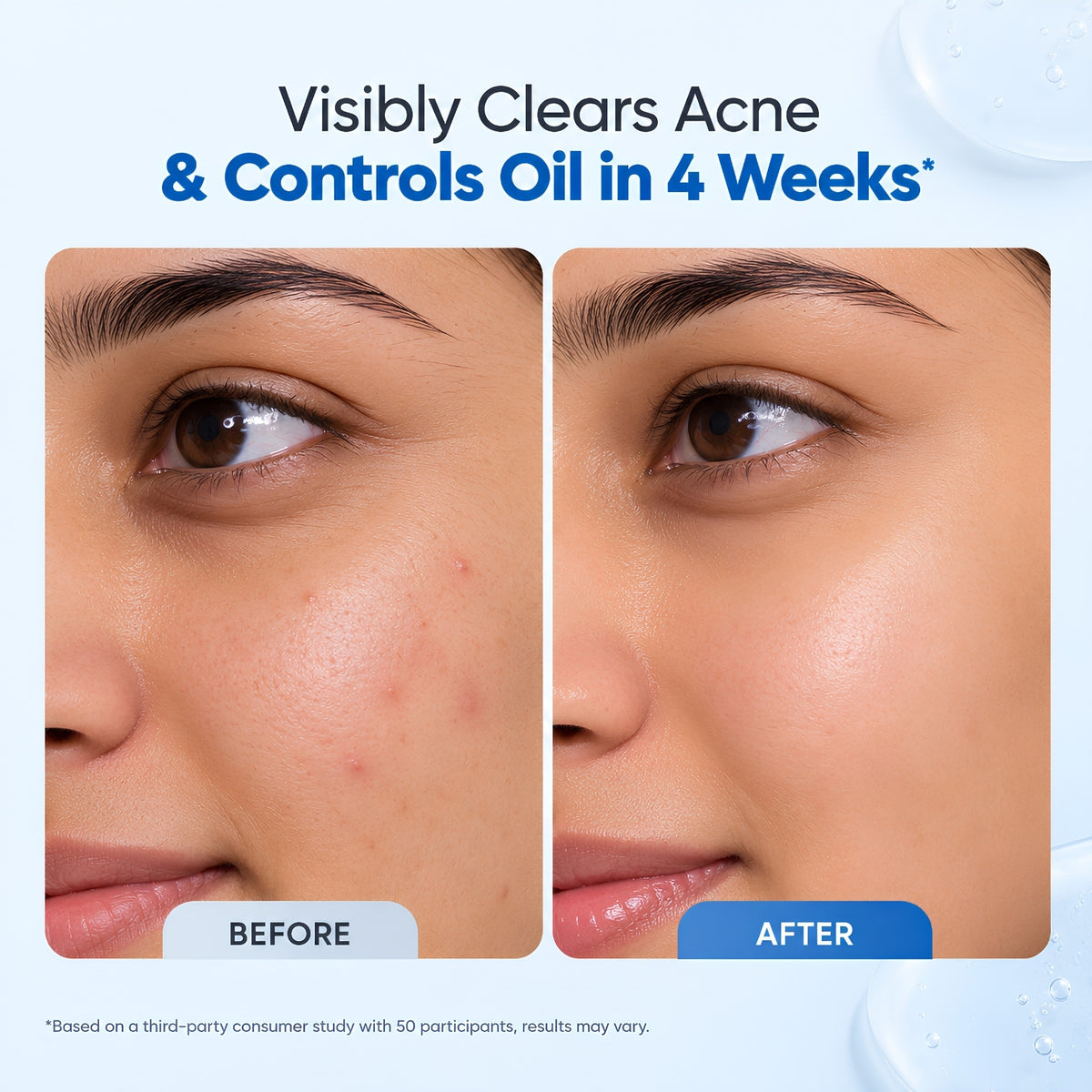 Oil + Acne Control Face Wash with Salicylic Acid & Niacinamide – 100ml