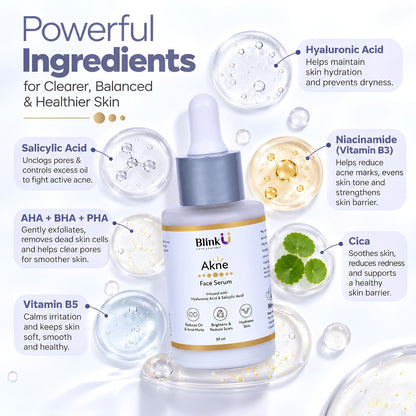Akne Face Serum with 5% Niacinamide & Salicylic Acid – 30ml