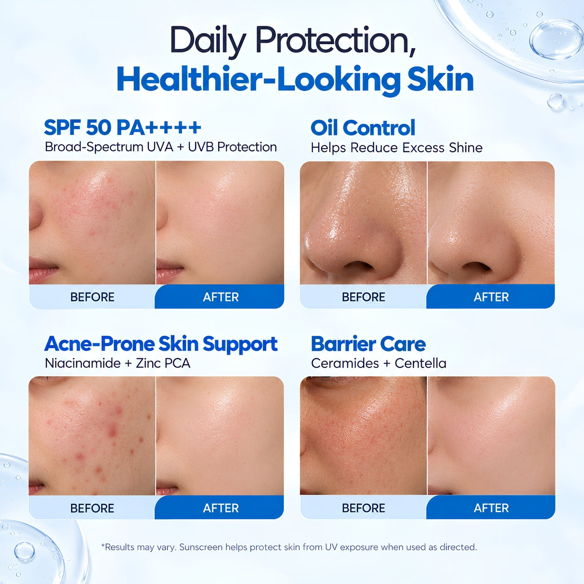 Oil + Acne Control Sunscreen SPF 50 PA++++ with Niacinamide & Zinc PCA – 50g