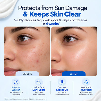 Oil + Acne Control Sunscreen SPF 50 PA++++ with Niacinamide & Zinc PCA – 50g